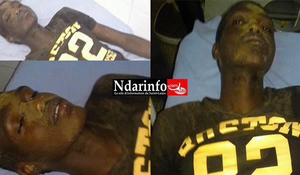 UGB : le film de l’agression de l’étudiant Alboury NIANG.