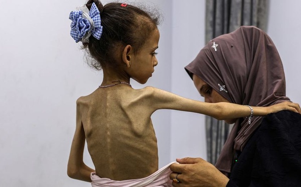 L'ONU déclare officiellement l'état de famine à Gaza, la première à toucher le Moyen-Orient