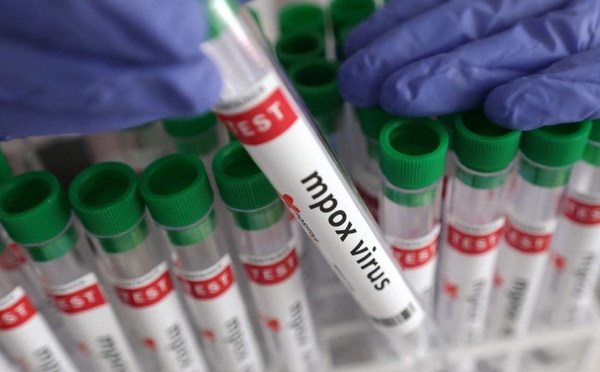 Dakar annonce un nouveau cas de Mpox après trois semaines sans infection active