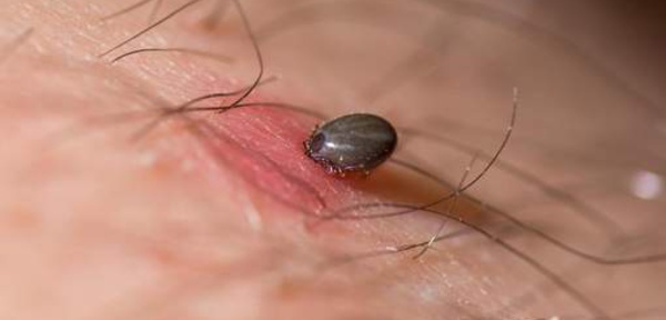 La maladie qui pousse les gens au suicide et dont on parle trop peu