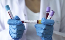 Coronavirus au Sénégal : 12 cas positifs et 6 guéris, ce samedi