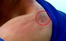 Luis Suarez sera sanctionné par la FIFA, qui ouvre une procédure disciplinaire