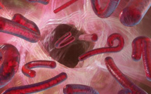 La menace de la propagation de  la fièvre hémorragique à virus Ebola: une opportunité pour le renforcement  du système de santé du Sénégal