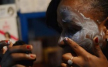 Sénégal : un taux de mortalité alarmant lié à la dépigmentation