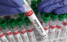Dakar annonce un nouveau cas de Mpox après trois semaines sans infection active