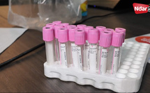 Saint-Louis : 10 cas de fièvre de la Vallée du Rift détectés, riposte sanitaire enclenchée