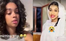 Hématome sans fracture : La marque suspecte sur la tête de la tiktokeuse Khady Sow