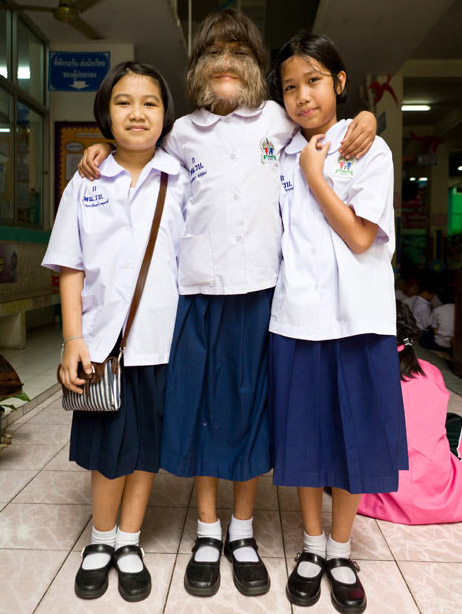 femme-fille-la-plus-poilue-record-du-monde-Supatra-Sasuphan-9 femme-fille-la-plus-poilue-record-du-monde-Supatra-Sasuphan-9